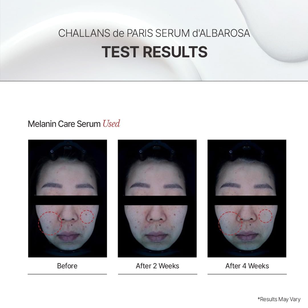 CHALLANS DE outer box with bottle showing premium Korean skincare packaging