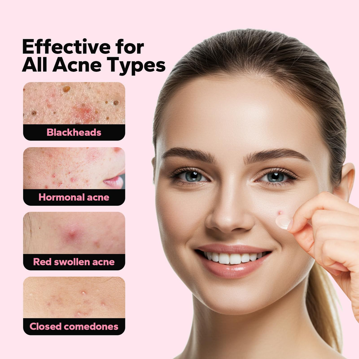CharmCherry skin-colored patch applied to cheek reducing redness
