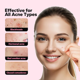 CharmCherry skin-colored patch applied to cheek reducing redness