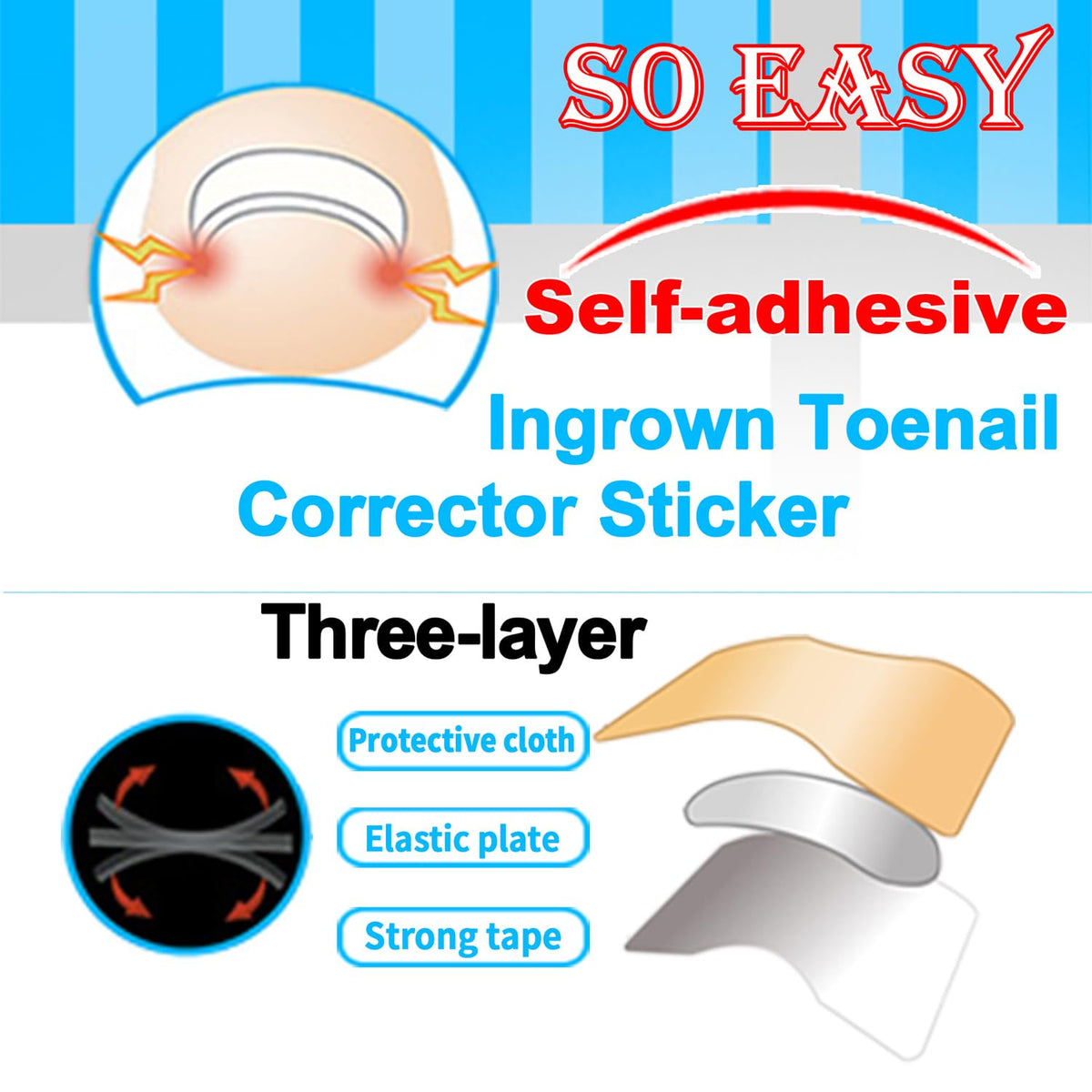 CHEMAILON U-shaped corrector patch detail illustrating secure nail cradle