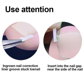 CHEMAILON lifter and painless file tools shown for precise toe adjustments