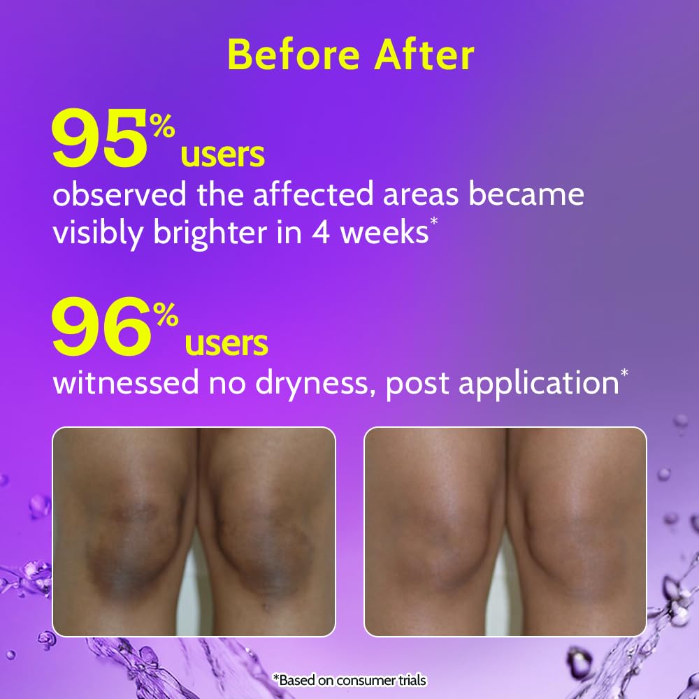 Chemist at Play roll-on applied to neck showing ease of use and smoother-looking skin