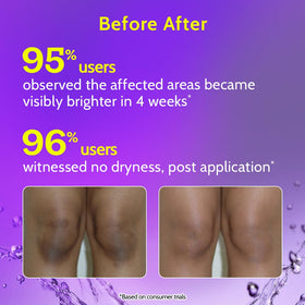 Chemist at Play roll-on applied to neck showing ease of use and smoother-looking skin