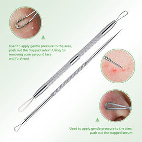 ChenYiJin tool in use on nose demonstrating precise blackhead extraction