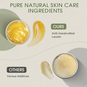 Chialing cream on fingertip demonstrating easy spread and protection