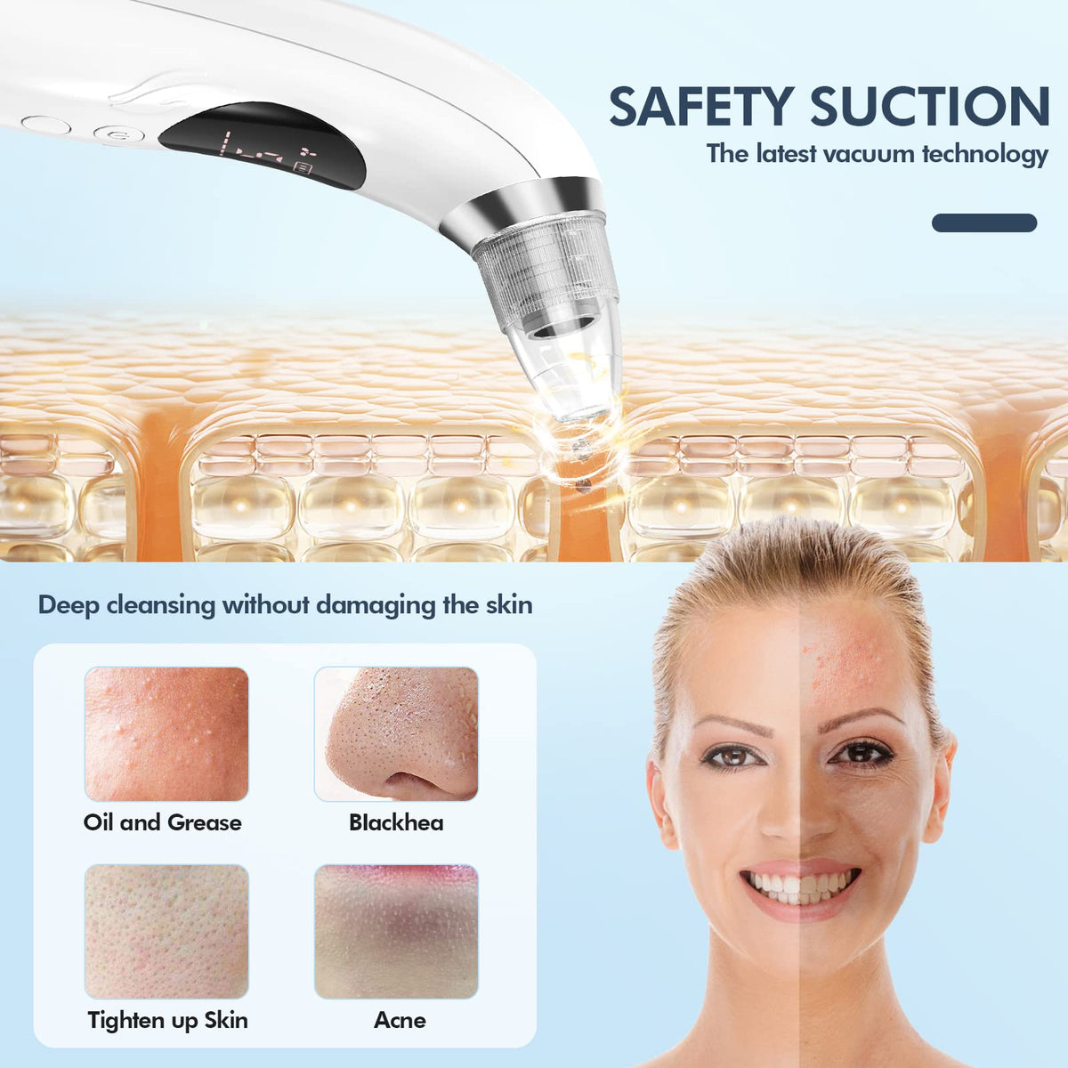 CHIMOCEE device in use on nose area demonstrating targeted blackhead removal