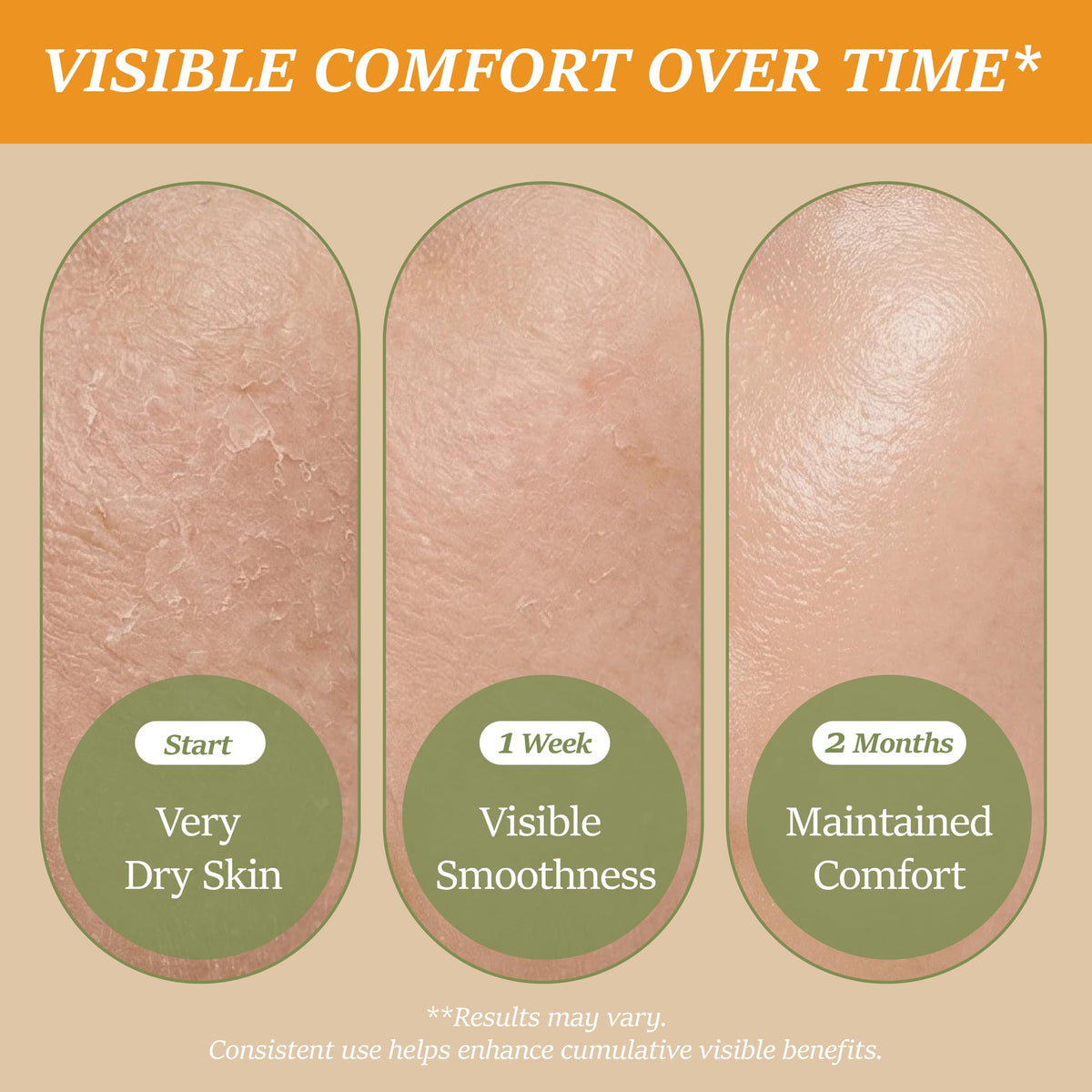 ChiroLife balm dabbed on lips demonstrating soothing hydration for chapped lips