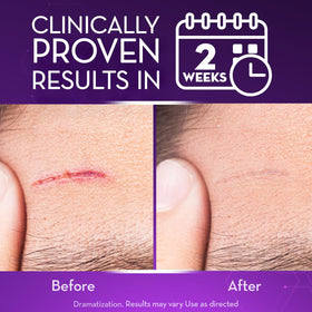 Cicatricure gel texture dollop demonstrating smooth, non-greasy formula