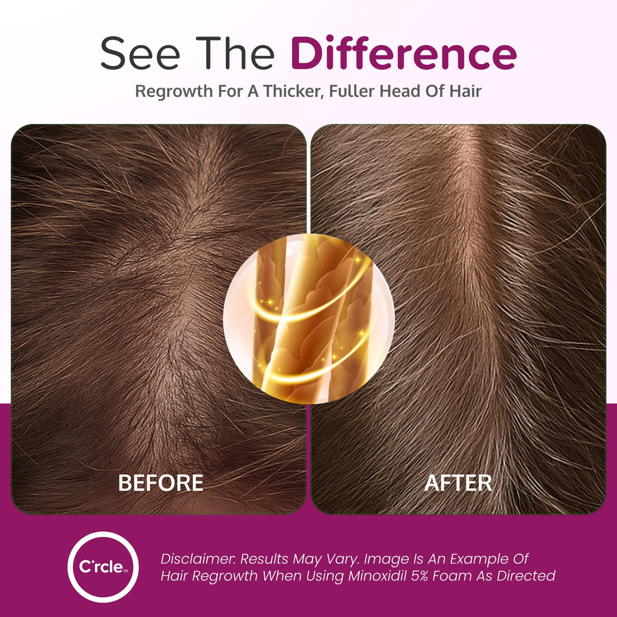 C'rcle applied to scalp targeting thinning area for focused treatment