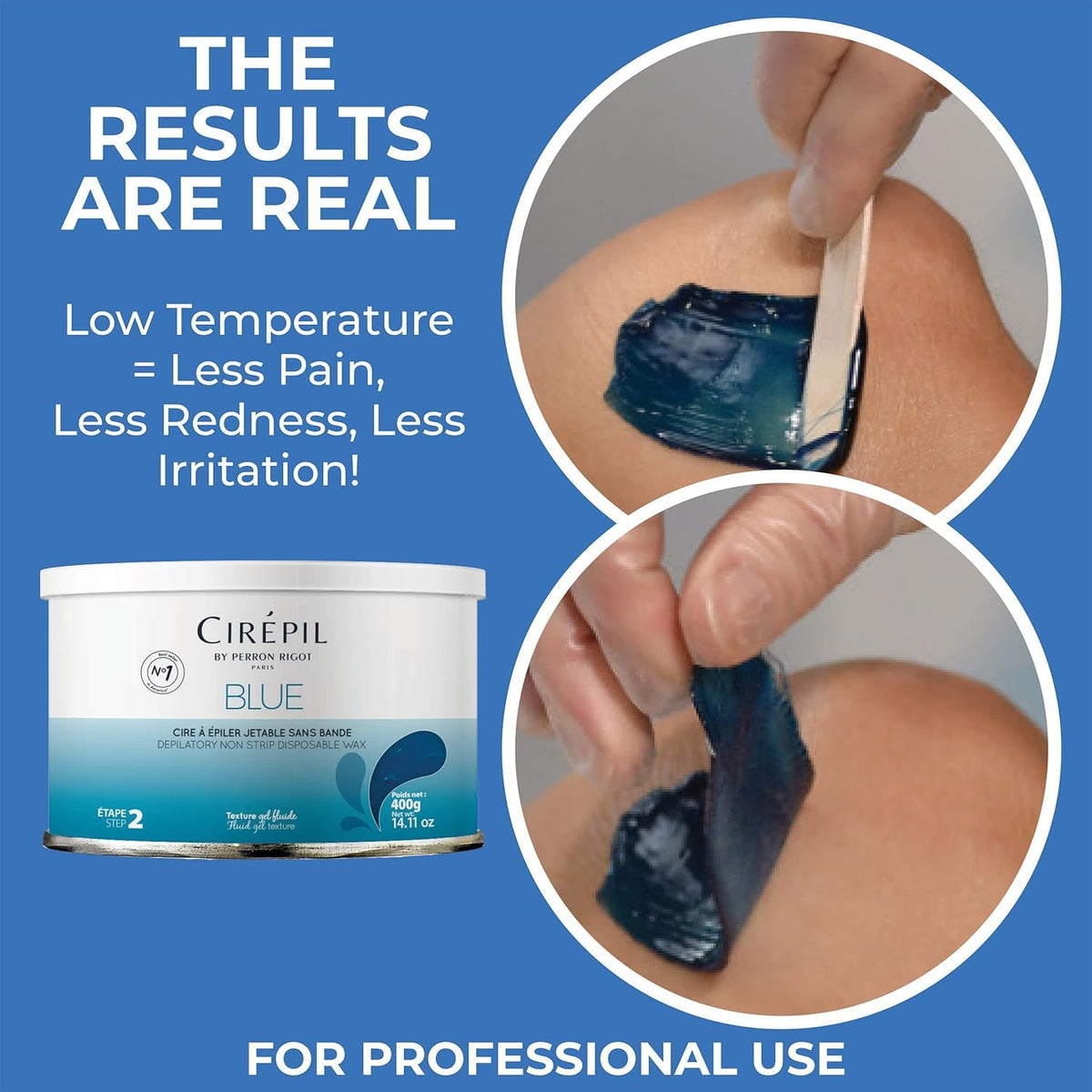 Cirepil blue used on facial area showing effective peach-fuzz removal benefit