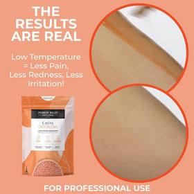 Professional applying Cirepil Cristalline on face showcasing gentle, low-temp removal