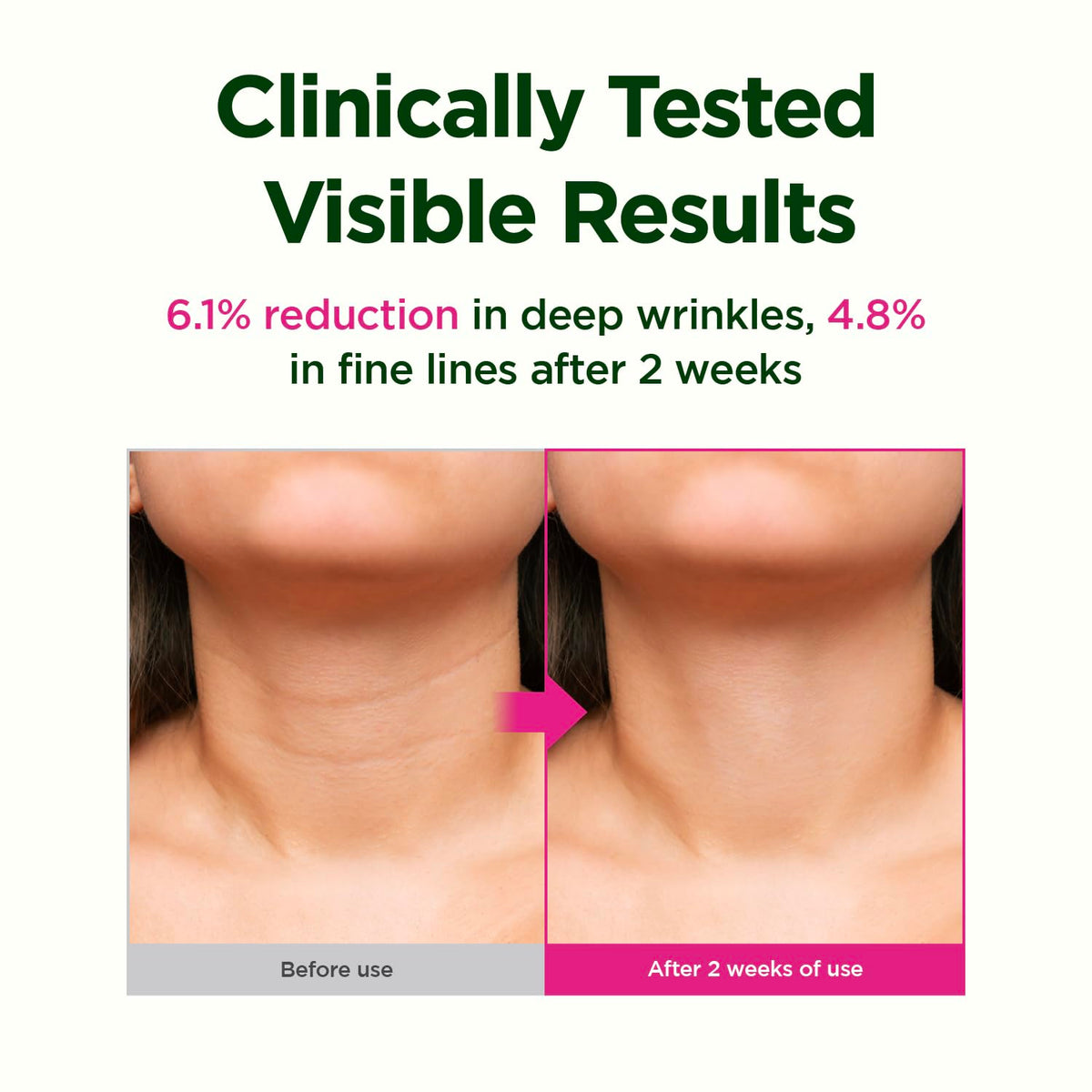 CKD Guaranteed scale comparison before and after illustrating visible contour benefit