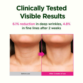 CKD Guaranteed scale comparison before and after illustrating visible contour benefit