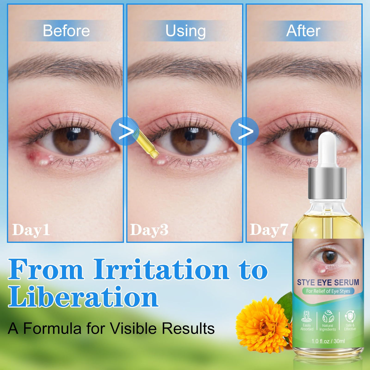 clabay applying serum along lash line to soothe irritation and redness