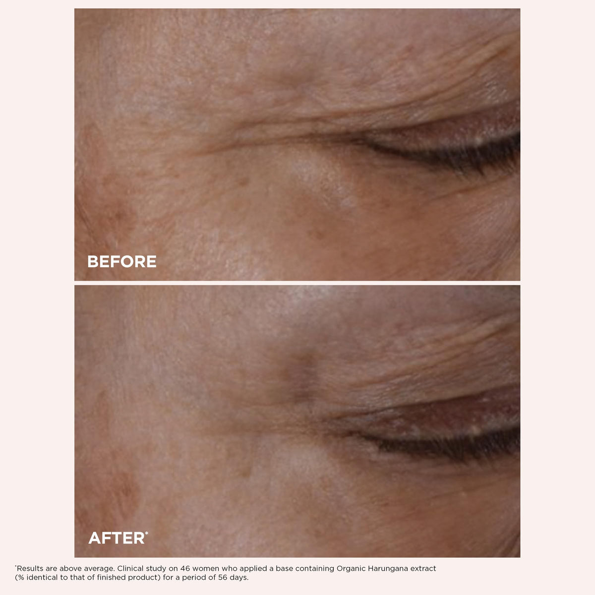 Clarins Total Eye Lift on fingertip ready for application to deliver immediate firming