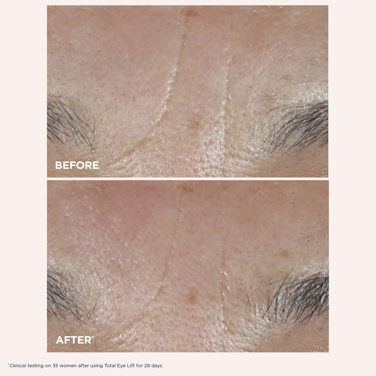 Clarins Total Eye Lift being applied around eye demonstrating depuffing action