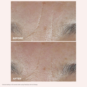 Clarins Total Eye Lift being applied around eye demonstrating depuffing action