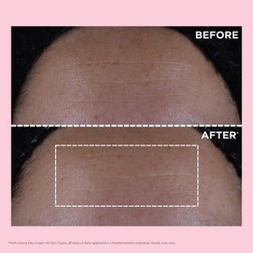 Clarins product label and ingredient listing emphasizing niacinamide benefit