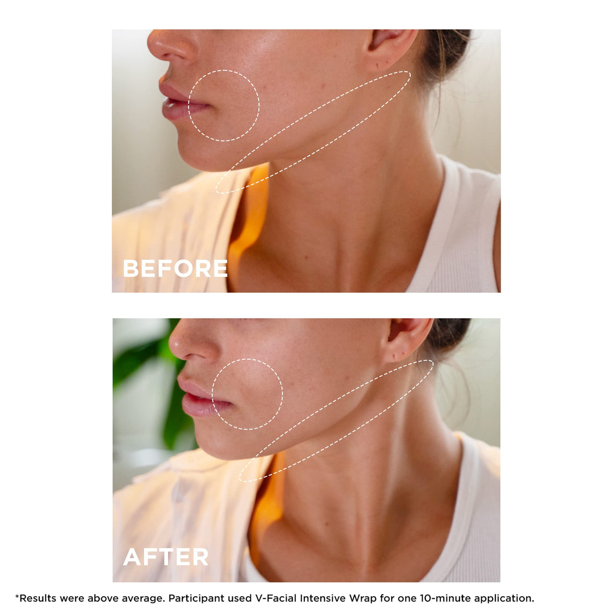 CLARINS before and after scale comparison showing reduced puffiness and refined facial contour