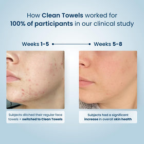 Clean Skin Club towels displayed in bathroom for easy daily access