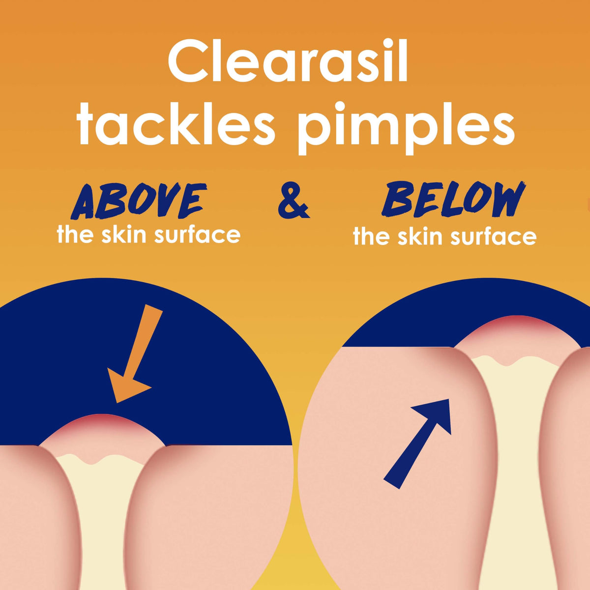 Close-up of Clearasil pad texture highlighting gentle exfoliation