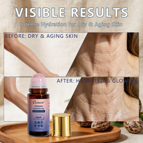 CLERVUN castor oil texture on skin showing lightweight moisturizing finish