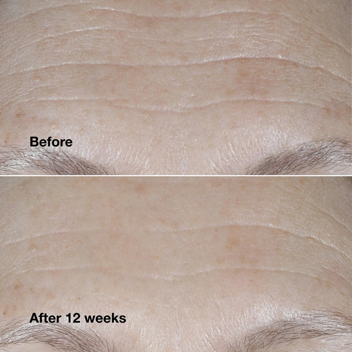 Clinique application on face with fingers for easy morning use