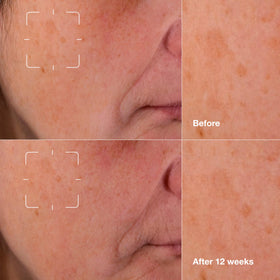 Clinique label detail highlighting UP302 and ingredient information for clarity