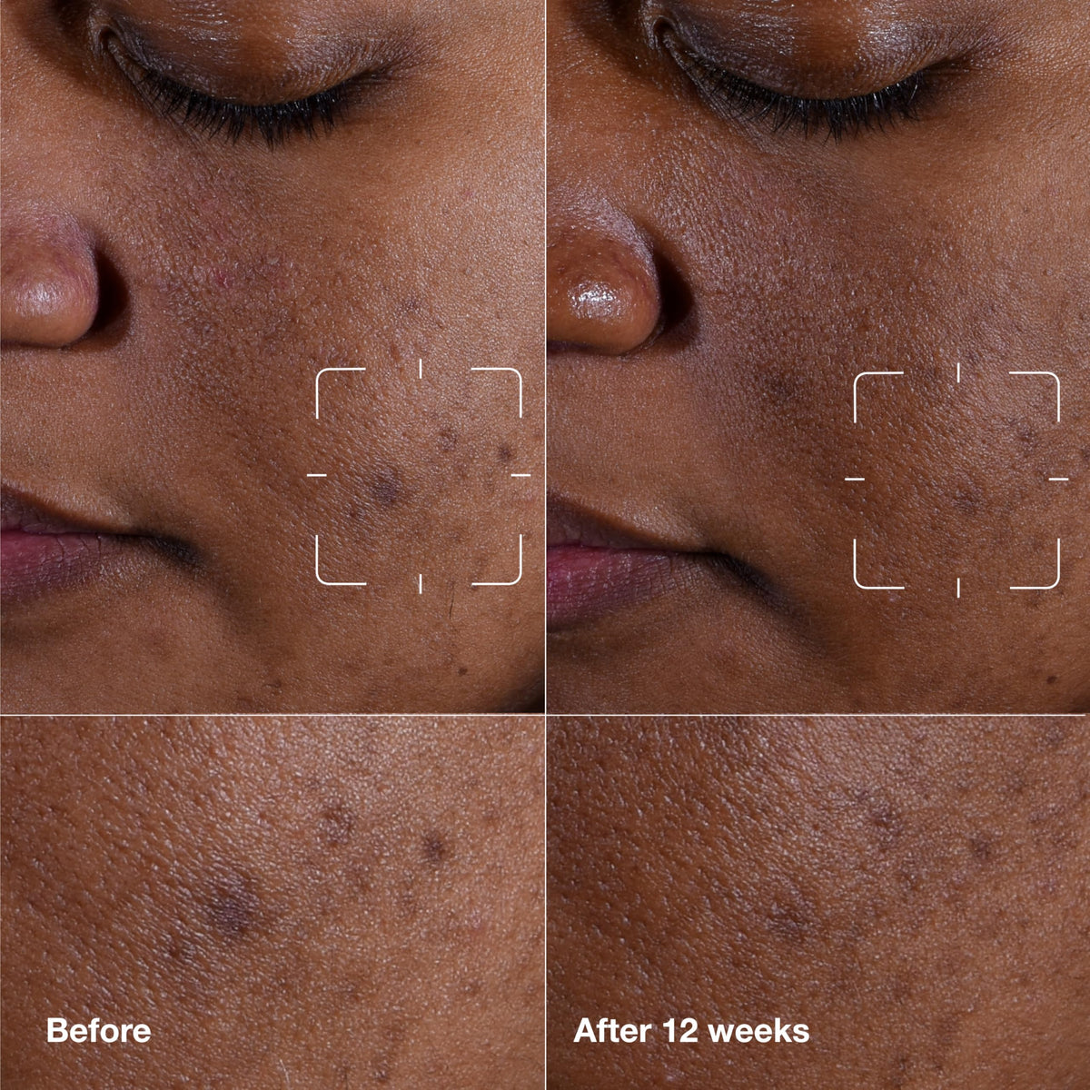 Clinique close-up of dropper dispensing lightweight serum texture for fast absorption