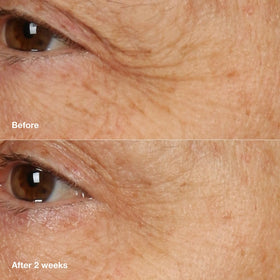 Clinique cream applied on model cheek demonstrating overnight hydration benefit
