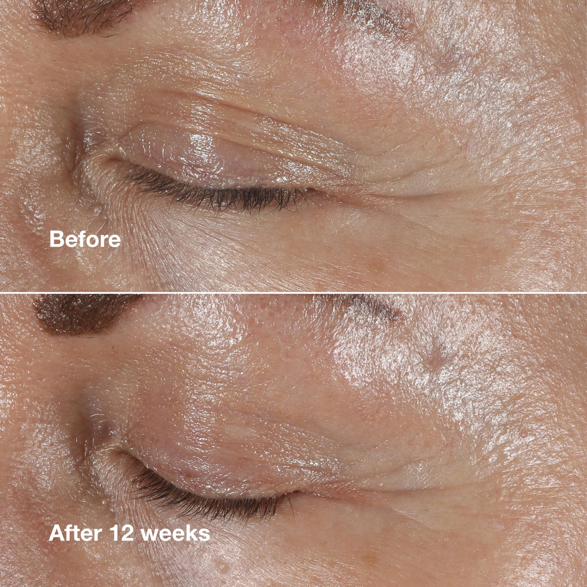 Clinique eye cream amount on fingertip demonstrating how little is needed