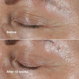Clinique eye cream amount on fingertip demonstrating how little is needed
