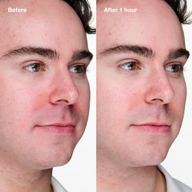Clinique product with witch hazel ingredient bottle highlighting oil-refining benefit