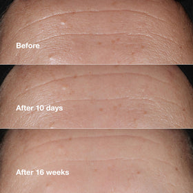 Clinique visual of hyaluronic acid and peptides representing active ingredients and skin support
