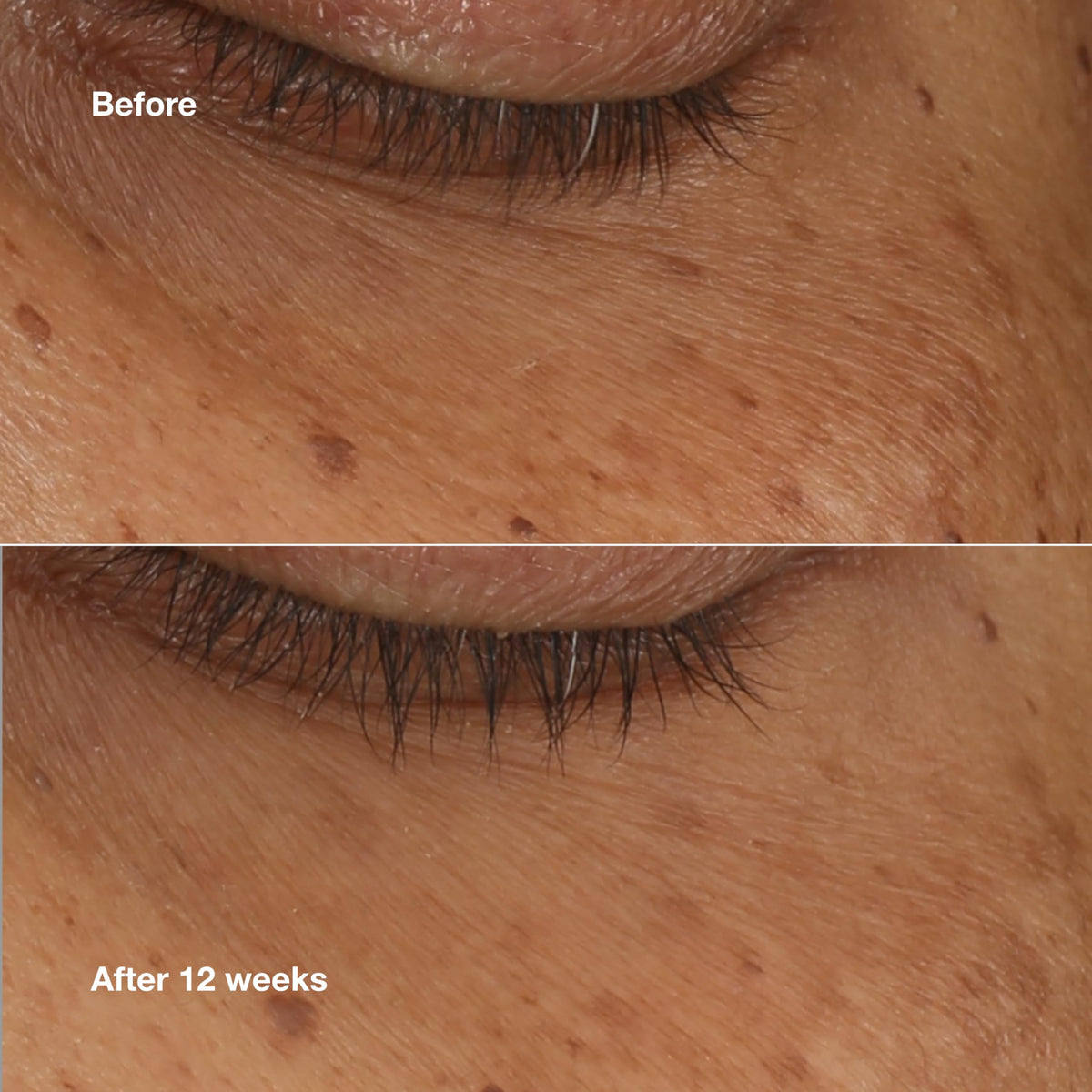 Clinique applicator applying serum under eye, shows precision and de-puffing benefit