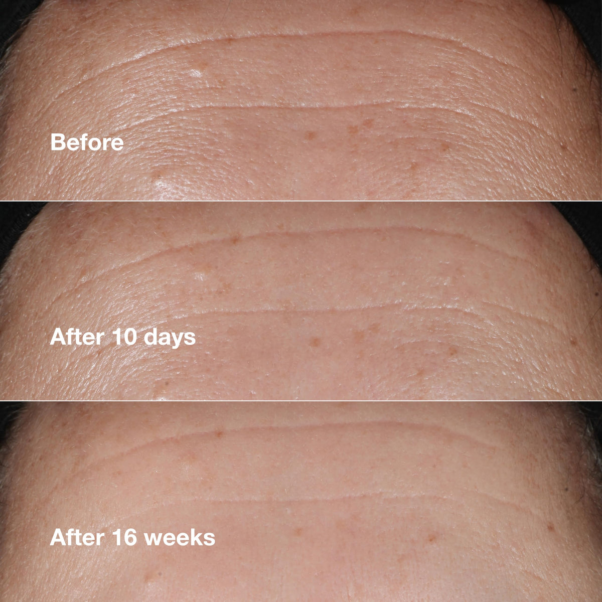 Clinique serum dispensed from dropper illustrating easy application and controlled dosing