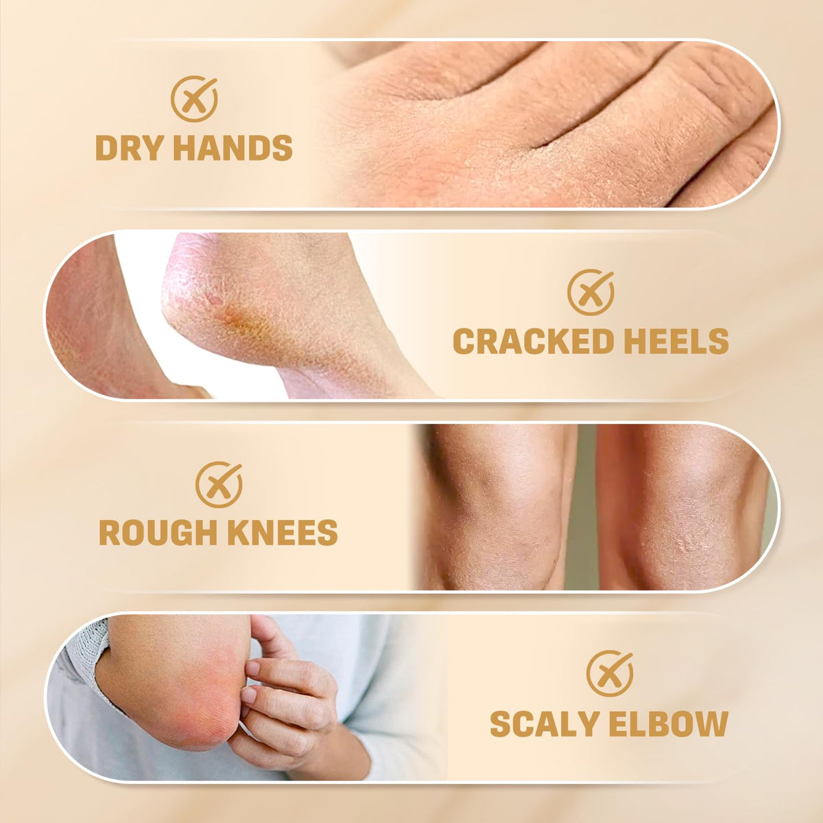 Clyecfra ingredients label closeup highlighting urea and salicylic acid strengths