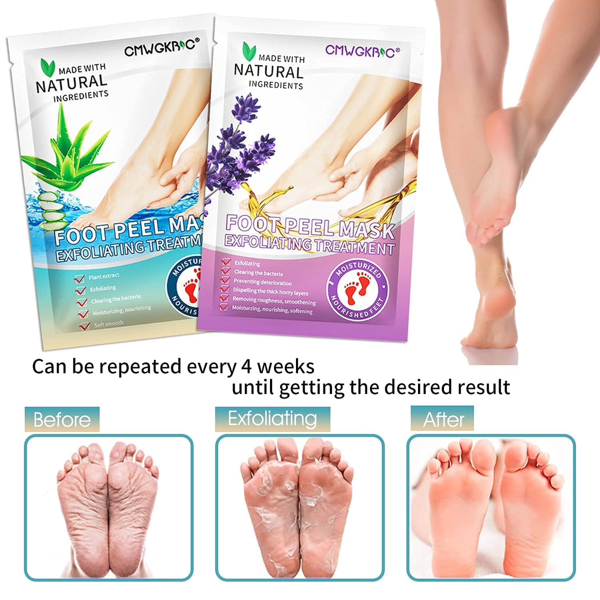 CMWGKBC before and after feet showing reduced calluses and softer skin