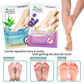 CMWGKBC before and after feet showing reduced calluses and softer skin