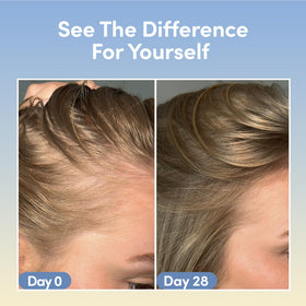 Coco & Eve serum being applied to scalp to support follicle health