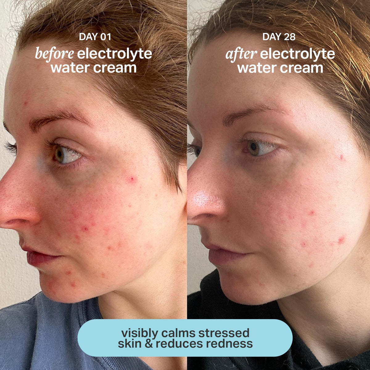 Cocokind gel absorbing into cheek demonstrating fast absorption and non-greasy feel