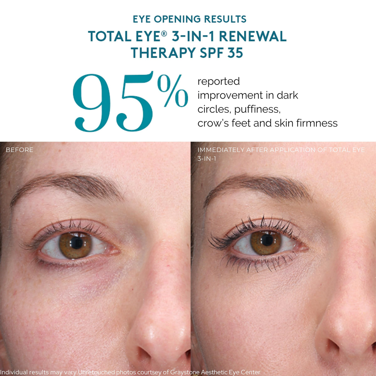 Colorescience Total Eye placed on bathroom vanity conveying daily skincare use