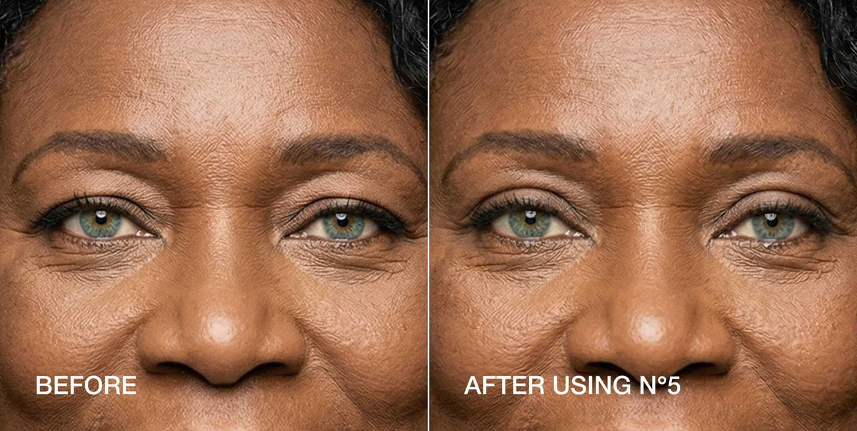 Contours Rx strip on eyelid in use demonstrating instant lifted appearance