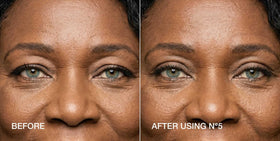 Contours Rx strip on eyelid in use demonstrating instant lifted appearance