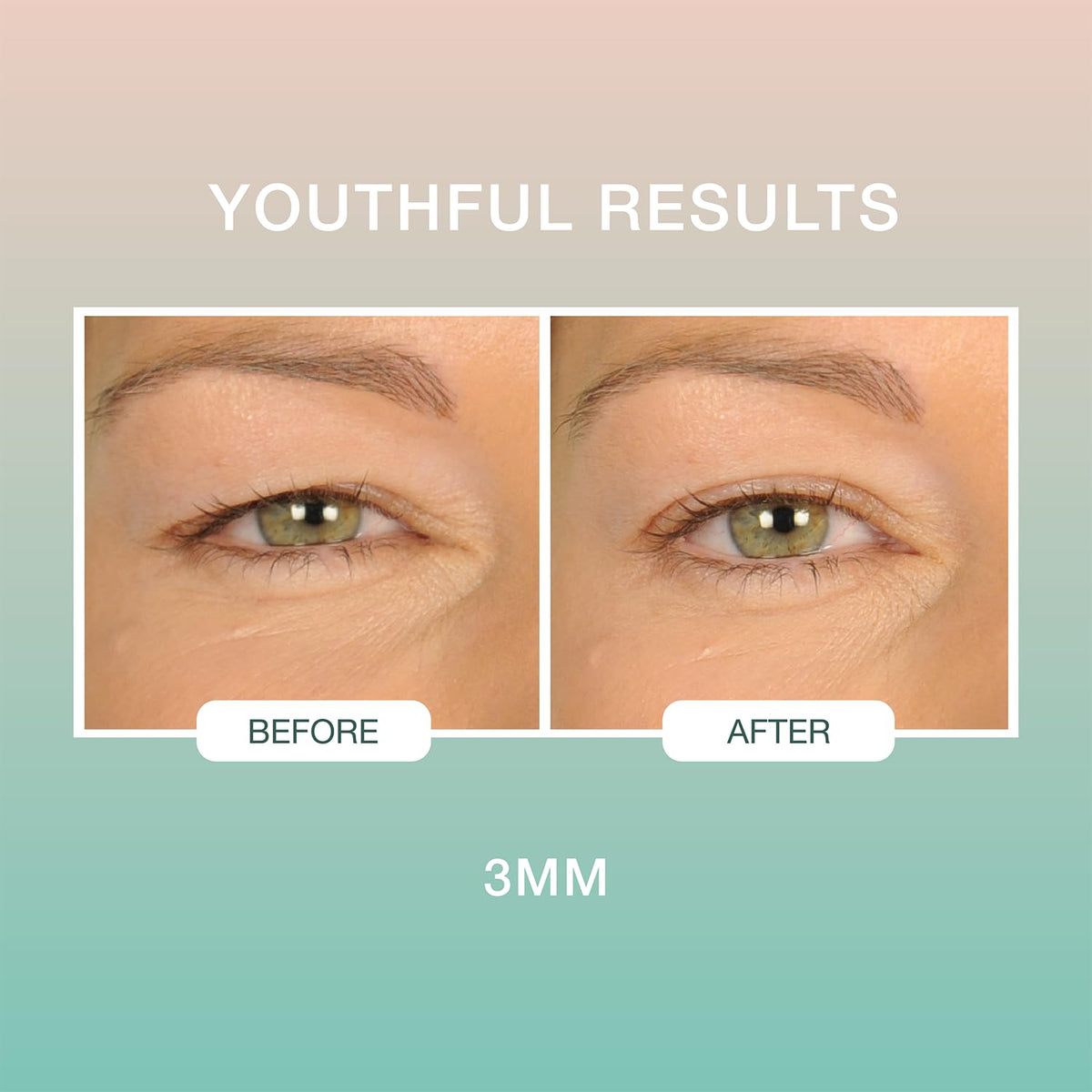 Contours Rx tweezers and strips laid out highlighting precise placement benefit