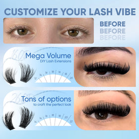 CORUSCATE before-and-after eye comparison illustrating dramatic volume transformation