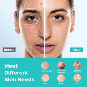 COSLUS FBS01 placed with serums and moisturizer showing improved absorption benefit