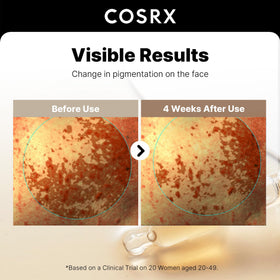 COSRX label close-up showing key ingredients and transparency benefit
