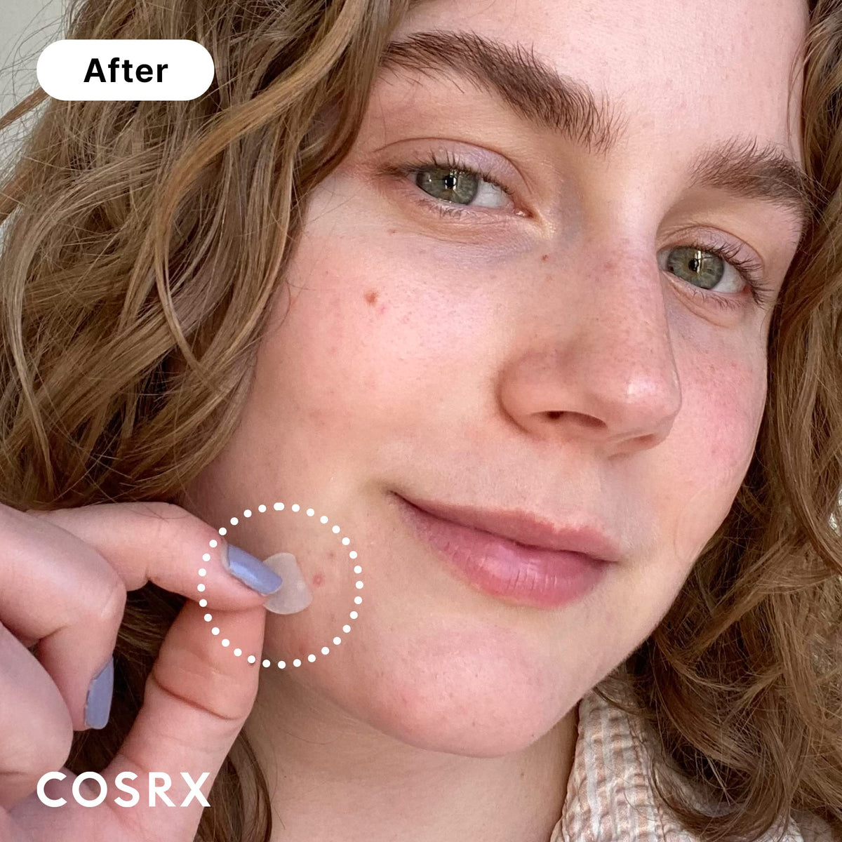 COSRX close-up of hydrocolloid patch texture for discreet absorption benefit