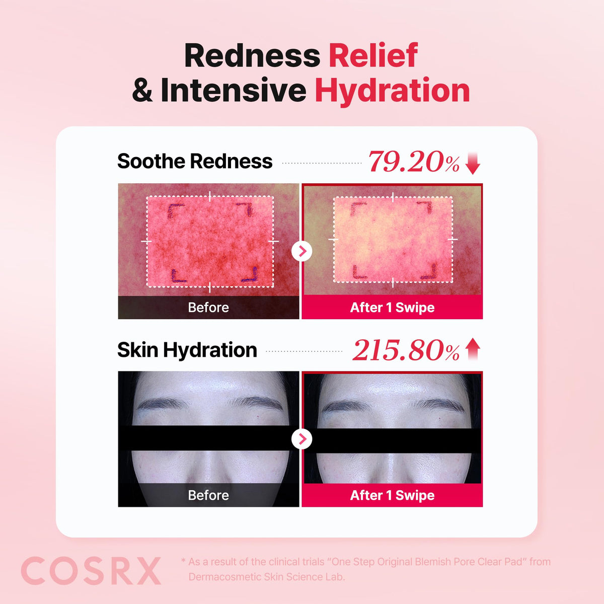 COSRX open jar of pre‑soaked pads ready to use for quick blemish care